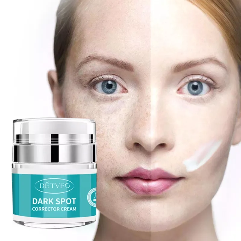 

China Best Bleaching Extra Strong Whitening Freckle Remove Face Cream For Dark Spots On The Face