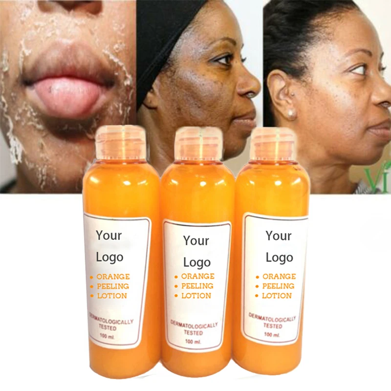 

OEM Vitamin C Orange Yellow Peeling Lotion for Removing Dead Skin and Whitening Smoothing New Skin Perfect White Lotion