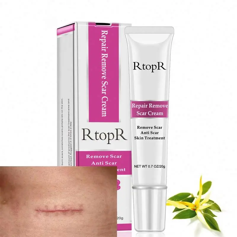 

new cheaper Best Natural Herbal Anti Acne Scar Treatment Removal Cream Face Skin Care Private Label Whitening Facial Cream