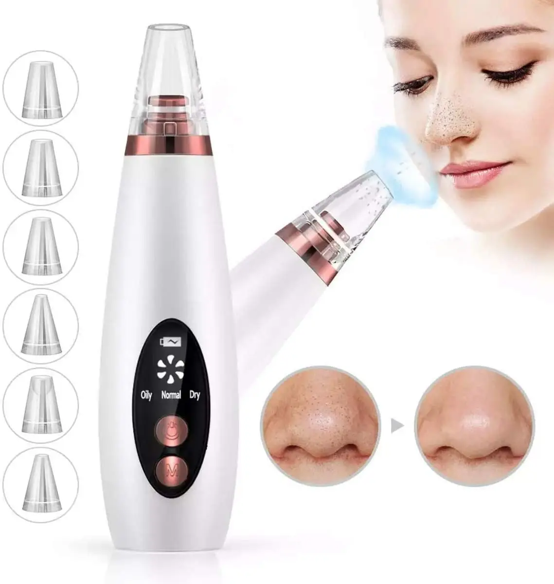 

Best electric blackhead & remover facial vacuum pore and cleaner removing machine extractor acne removal, White