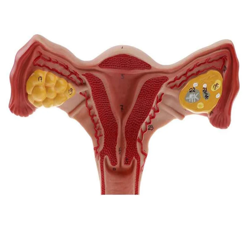 医学解剖学女性生殖器官模型,女性子宫模型医学 