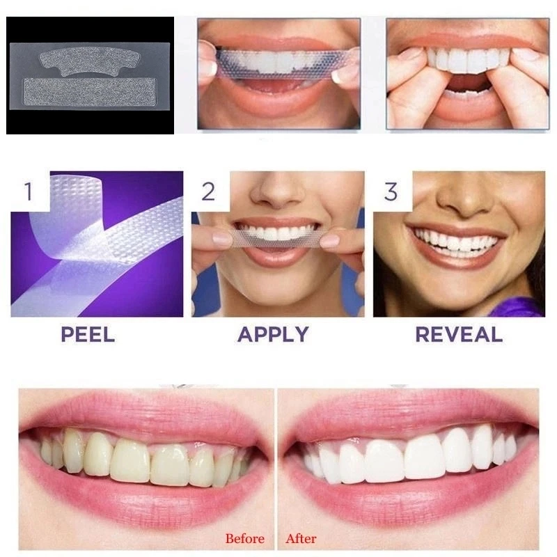 Для отбеливания зубов используют. Отбеливающие полоски для зубов 3d White Whitestrips. Отбеливающие полоски 7d White. Полоски для отбеливания зубов 5d White.