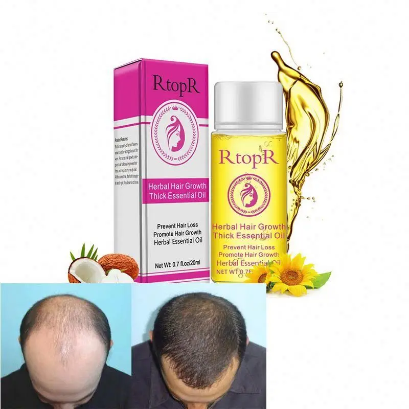 

60 ml hair growth oil for women rich in wild rose essence oil make hair absorb easily