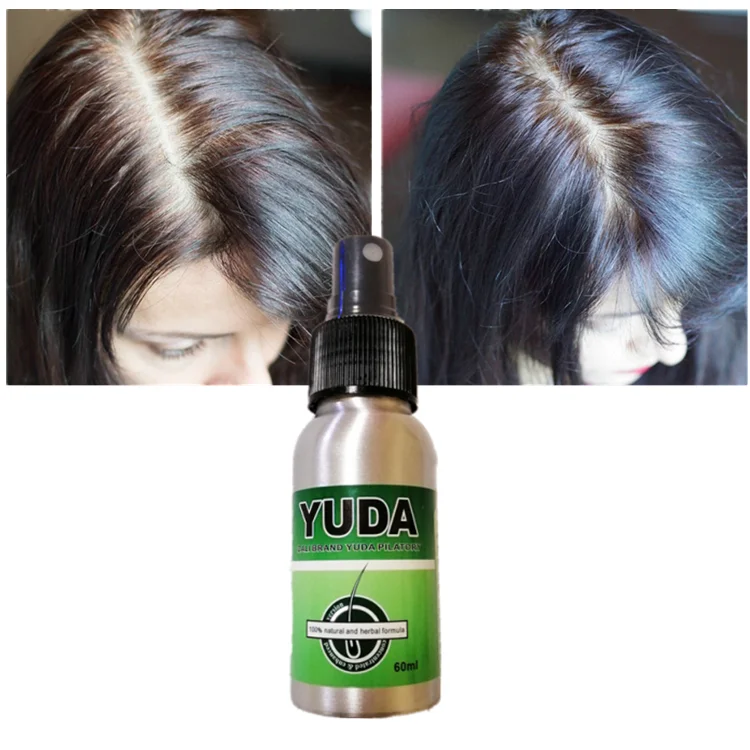 

Private Label Organic Herbal Yuda Hair Thickening Spray Hair Care Loss Treatment Hair Growth Oil Serum