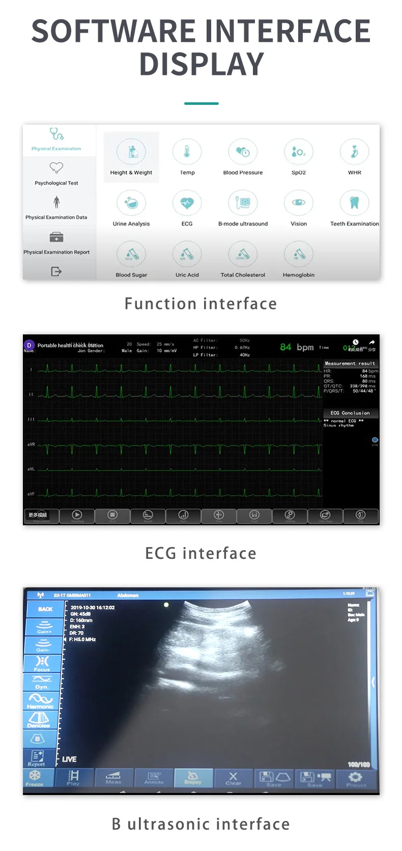 product clinical analytical instruments portable medical diagnostic machine 12 lead ecg bl0od pressure glucose-67