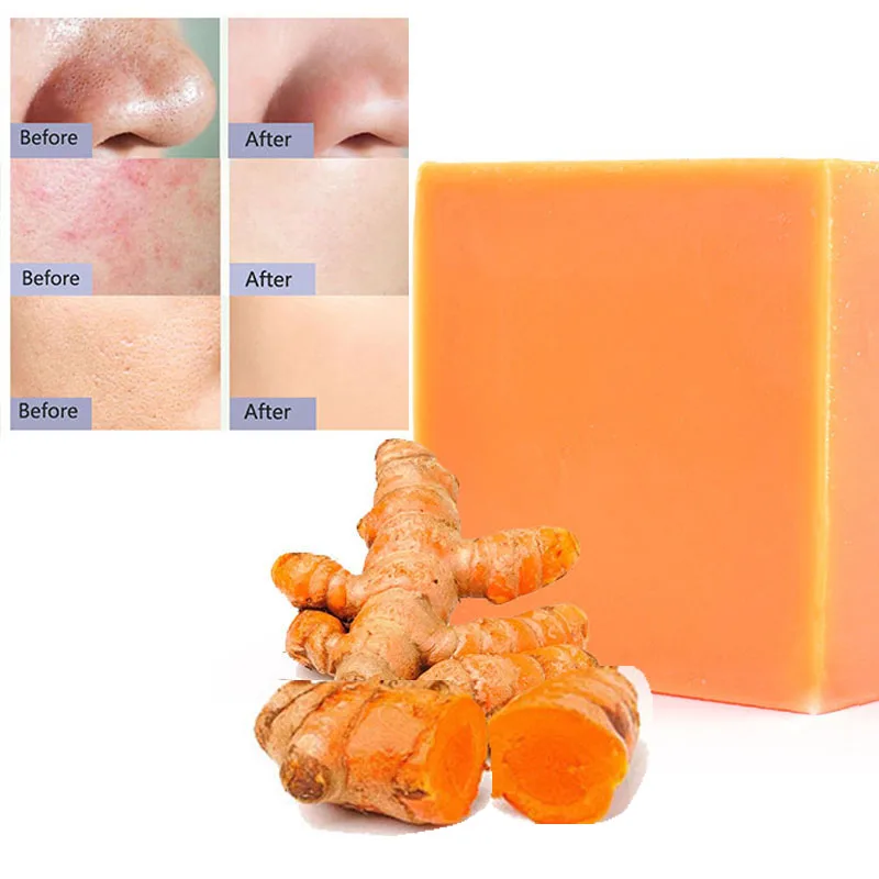 

wholesale skin care lightening whitening handmade natural tumeric kojic soap bar face body anti acne vegan Herbal turmeric soap