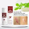 OEM High Quality Natural Skin Tight Anti-Cellulite Scar Remover Face Keloid Scar Removal Cream