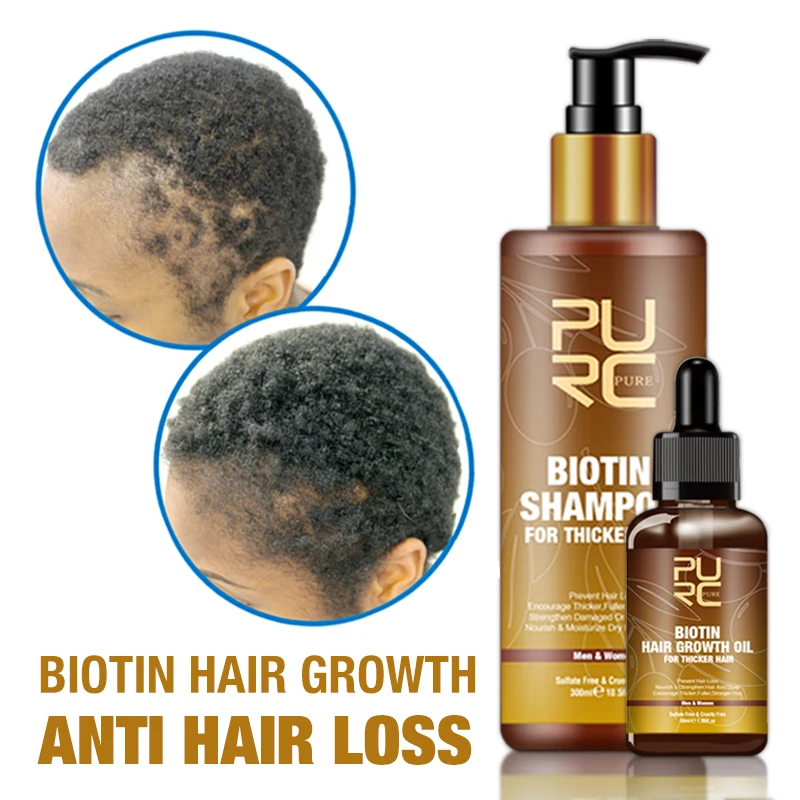 

Customize Natural Hair Growth Serum Organic Fast Hair Growth Oil For Black Women Private Label