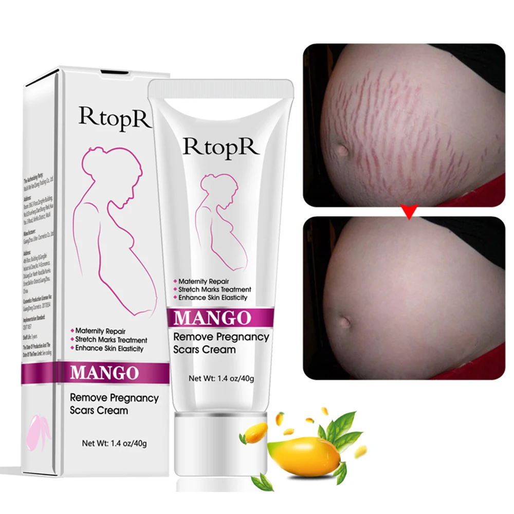 High Quality Scar Removal Cream