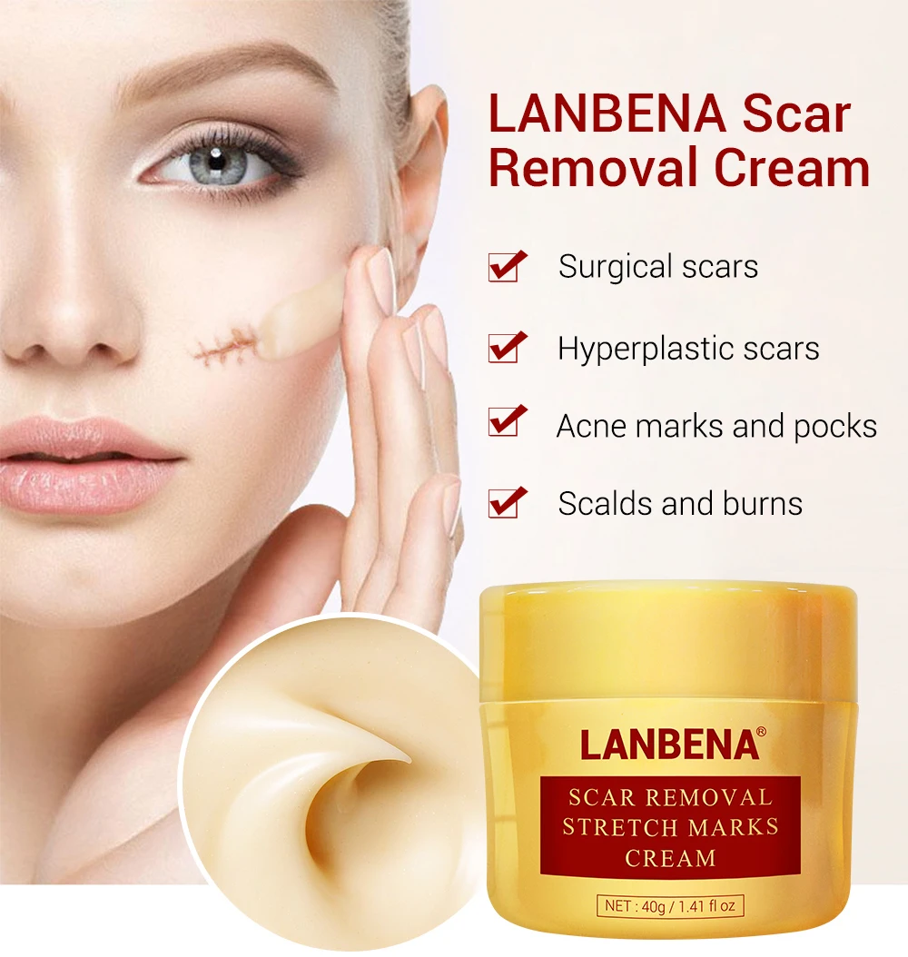 Wholesale Natural Anti Stretch Mark Cream And Burn Scar Remover Cream