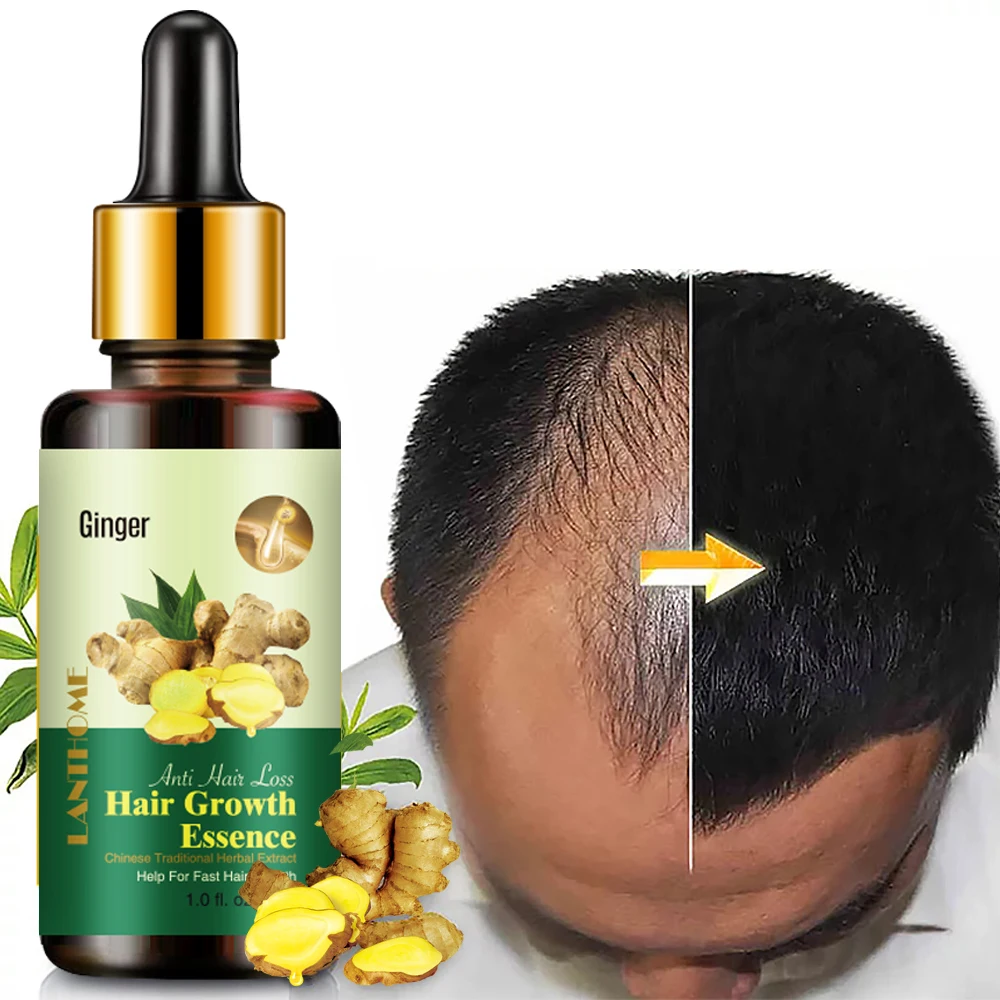 

Wholesale 30ml Ginger Oil 7 Days Hair Growth Essential Oil anti loss regrowth For Hair Loss Treatment Regrowth Serum