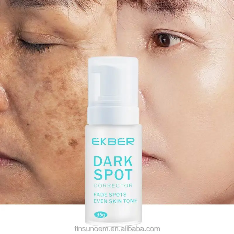 

Hot Sale Ekber Bulk Organic Whitening Anti Freckle Face Care Cream For Pigment Melasma Acne Pimples Dark Spot Corrector