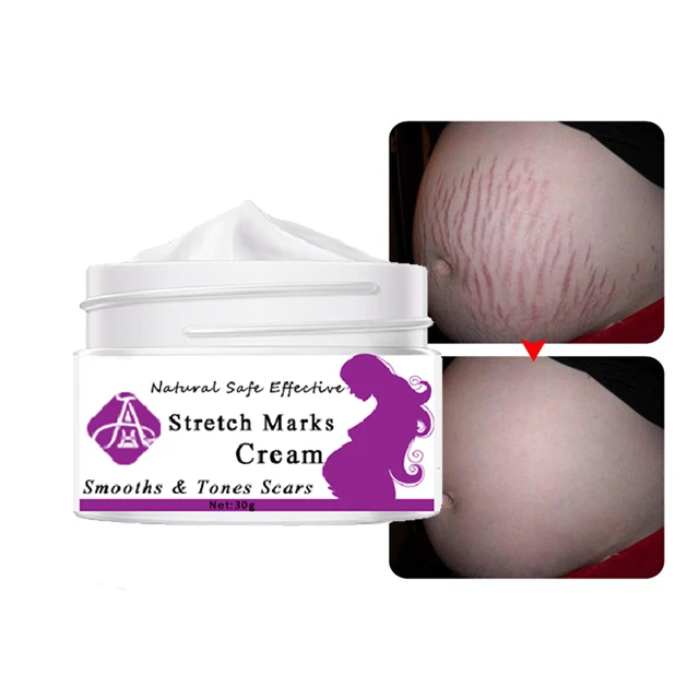 

AH Scar RemovalBest Stretch Mark Cream Removal Stretch Mark Cream for Pregnancy