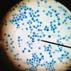 Complete set 100Pcs Microbiology slides,Microbiology slides for medical school