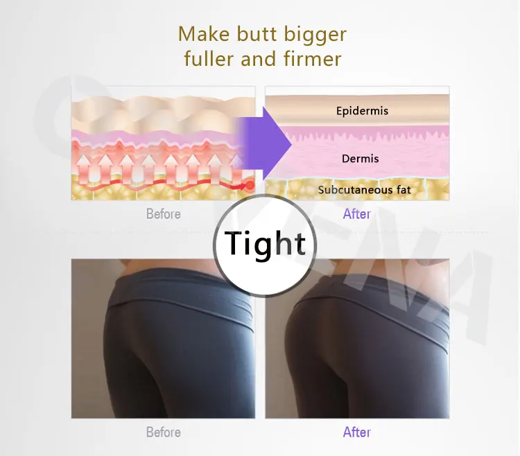 
OTVENA Natural Butt Massage Increase Buttocks Size Hip Lift Up Cream 