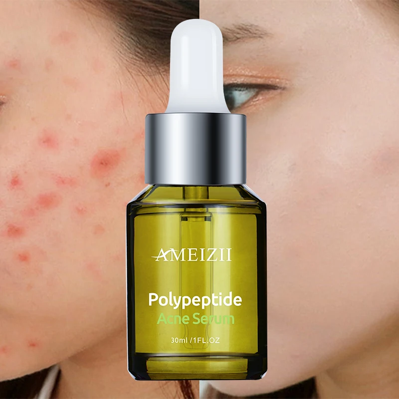 

Ameizii Natural Skin Repair Acne Pimple Dark Spot Facial Serum 30ML Peeling Solution Anti Acne Pimple Marks Polypeptide Serum