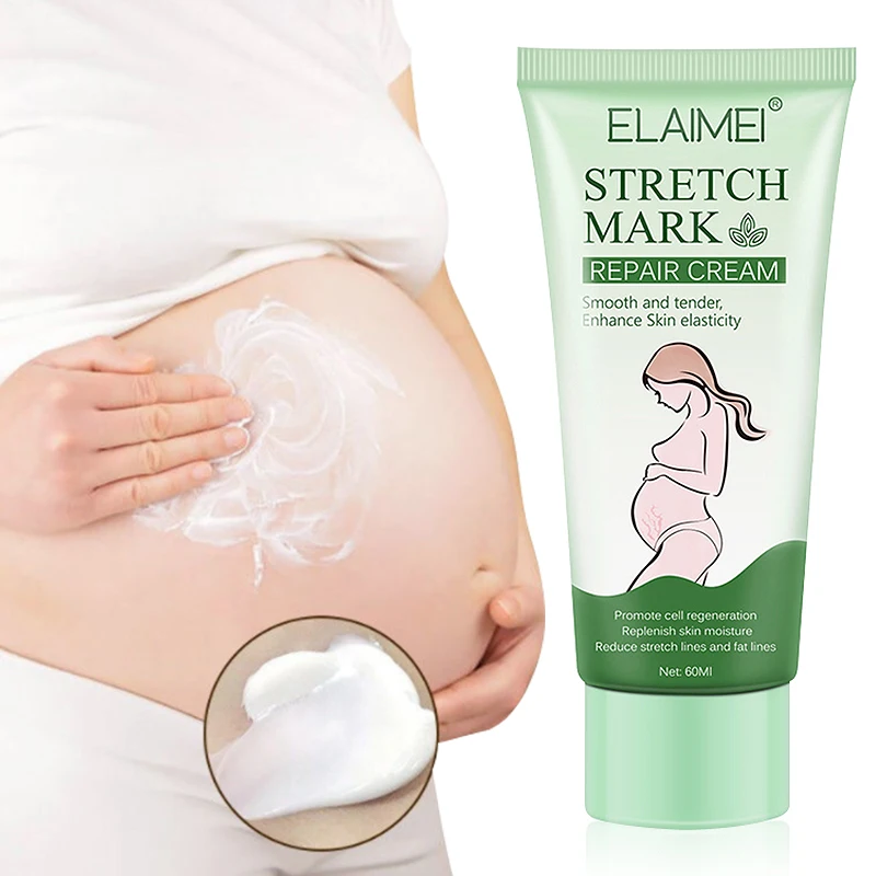 

private label Natural removal stretch marks cream organic stretch mark remover