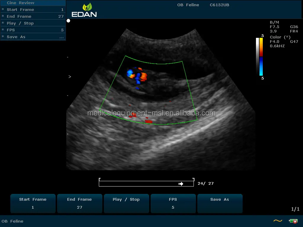 Portable 2d/3d Ultrasound Machine Edan U60 Color Doppler 