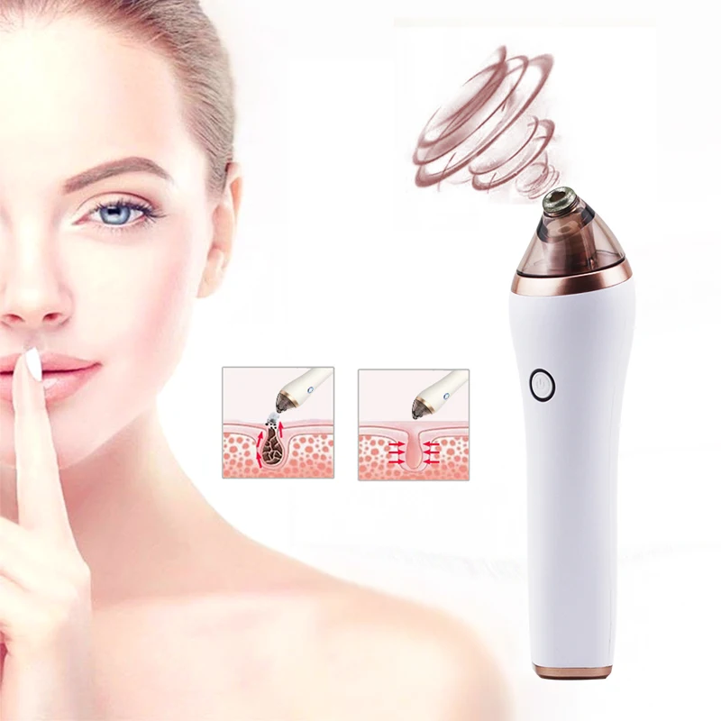 

Portable Electronic Facial peel machine pimple remover tool black head diamond microdermabrasion machine, Black ,white or custom