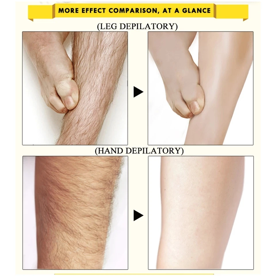 
Ginseng Body Hair Removal Cream Hand Leg Hair Loss Depilatory Cream Removal Armpit Hair Care Depilatory Cream 