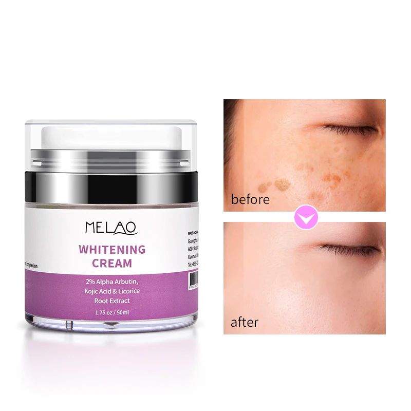 

OEM Private label organic Strong Removal Freckle melasma Armpit Sensitive Areas Whitening Lotion Bleaching whitening cream