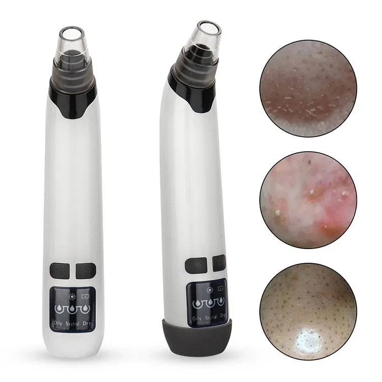 

Free sample face pore cleanser baby nose suction blackhead remover vacuum, White