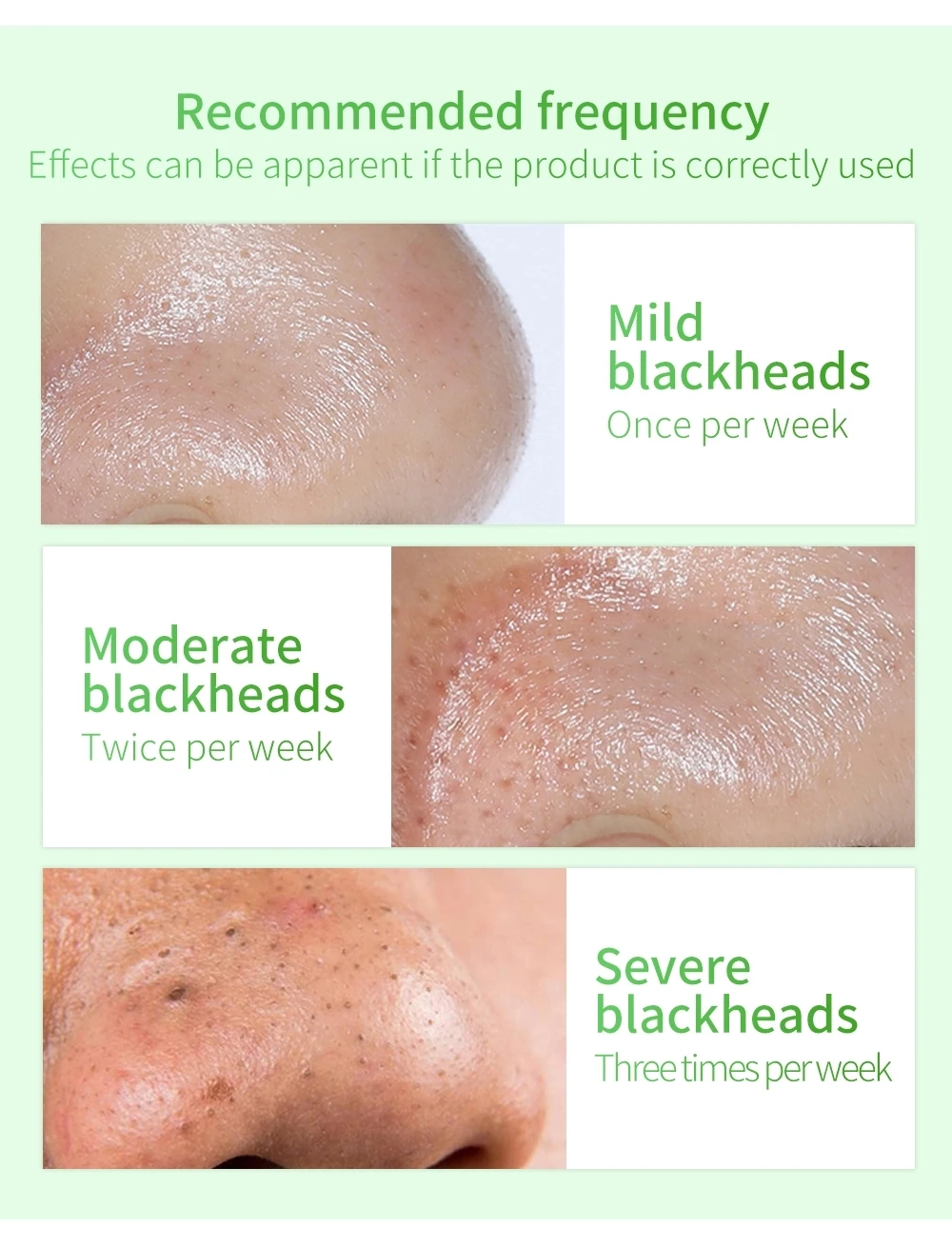 Lanbena Green Tea Shrinking Pore Tightening Deeply Clean Blackhead