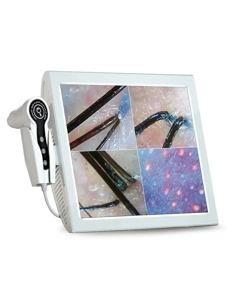 

15 Inch Digital HD Screen Home Use Skin and Hair Analyzer Help You Analysis Of Skin And Analysis Scanner Freeze Fixed