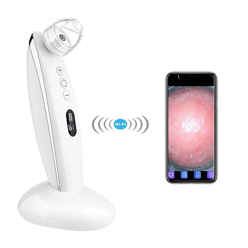 

Visual Blackhead Beauty Instrument with camera visible blackhead remover, White