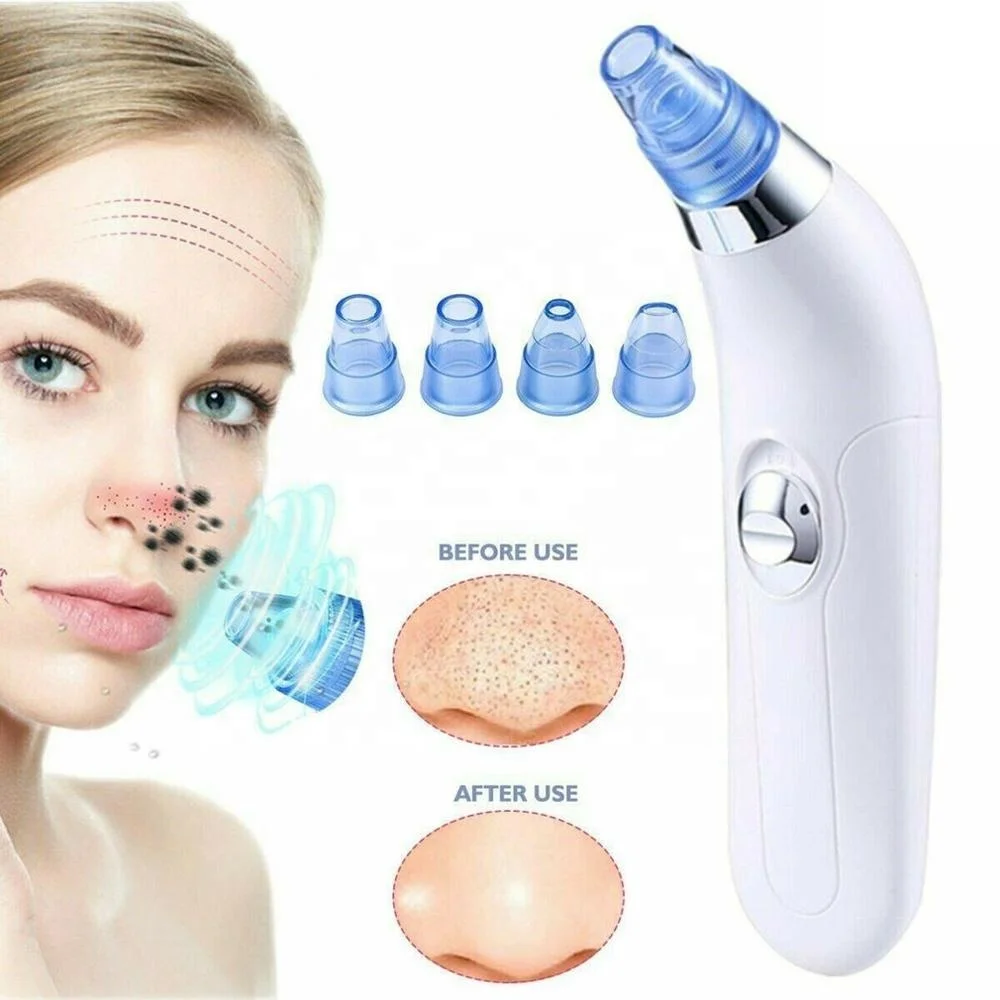 

Battery Blackhead Remover Vaccum Blackhead Suction Pore Vaccum Cleaner Blackheads Remover, White