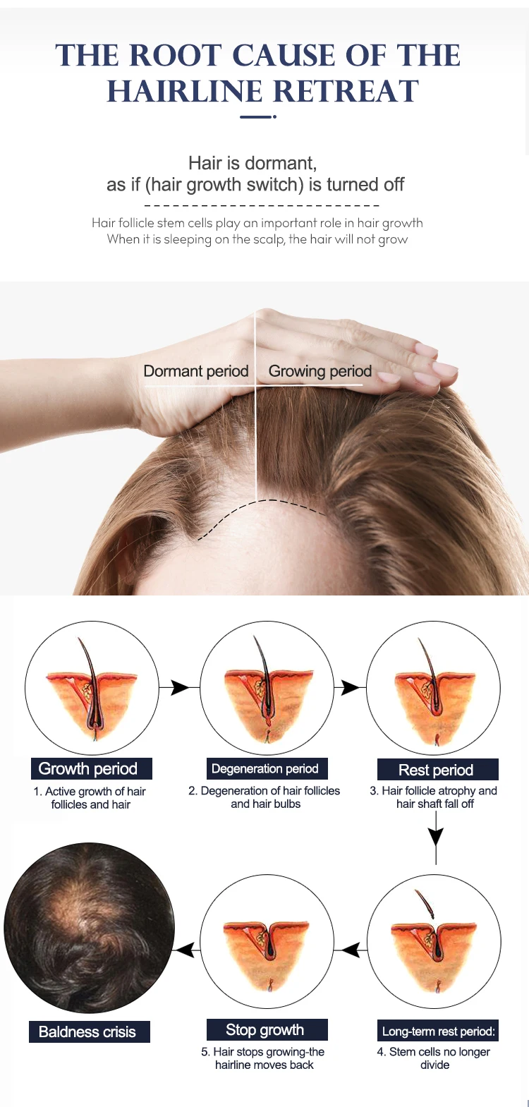 Oem Hair Follicle Activation Essence Nourish Activate Hair Follicles