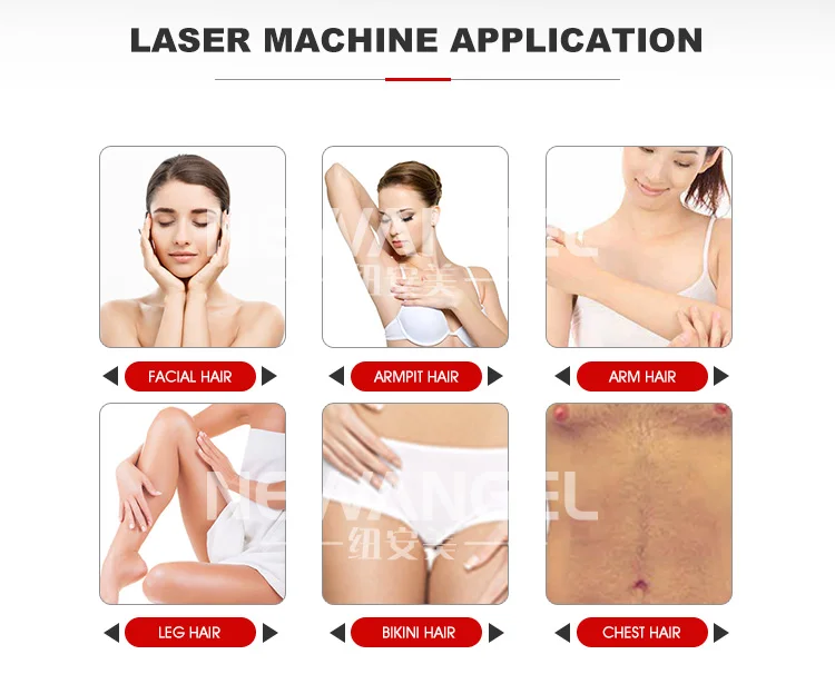 hair removal machine (7).jpg