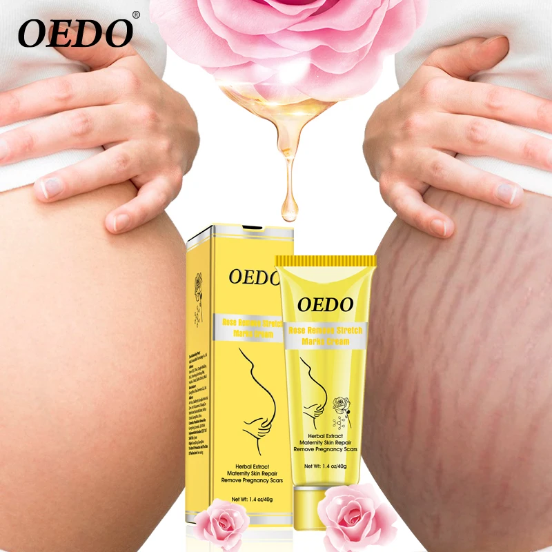 

Rose removes stretch mark cream anti-wrinkle anti-aging pregnant woman skin care repair pregnancy scar treatment body skin care