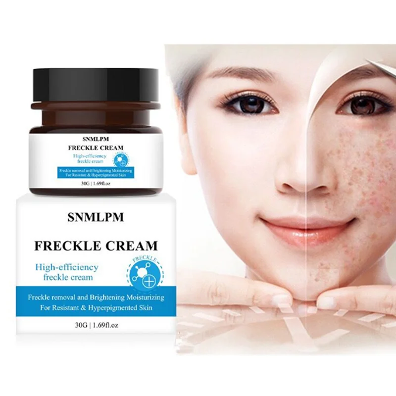 

Facial Skin Care Beauty Face Remove Pigmentation Spots Whitening Anti Best Freckle Removing Cream, White color