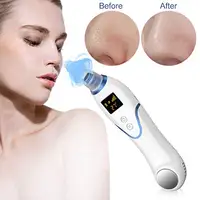 

FDA Certified OEM Beauty Cosmetics Skin Pore Cleaner Suction Heated Cool Blackhead Remover Vacuum