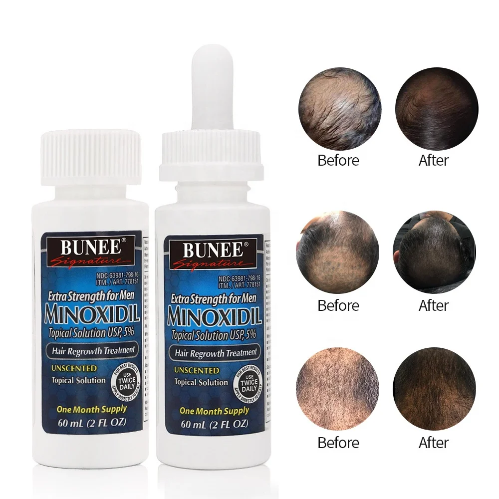 

Wholesale Free Sample OEM/ODM hair regrow serum oil for hair