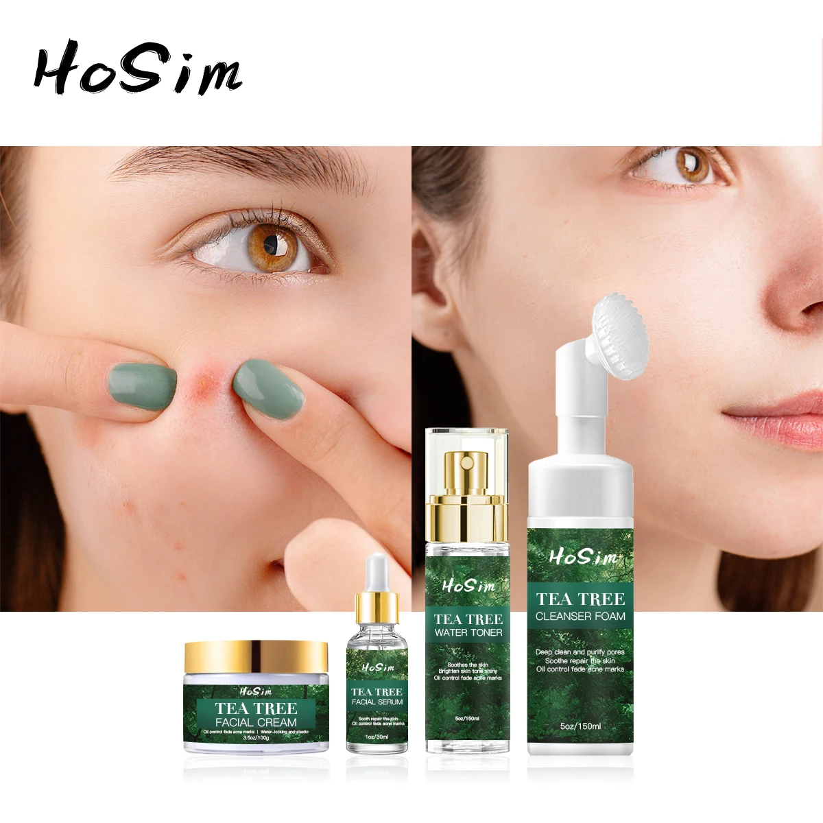 Alibaba Tree 4 Piece Acne Skincare Set