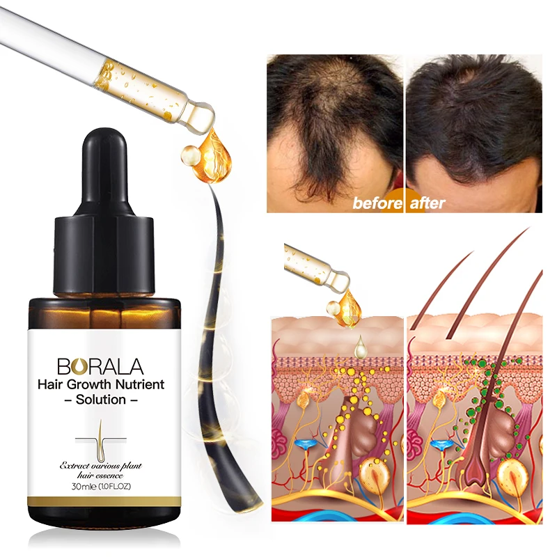 

Anti Hair Loss Nutrient hair Growth Promoter Growth Solution apply on hairloss area Cellular Hair Energy Combination