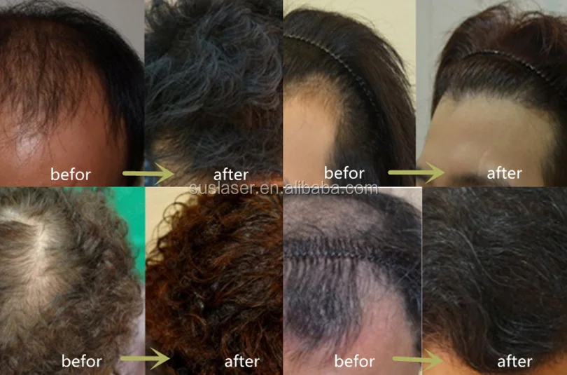 before and after 3.jpg