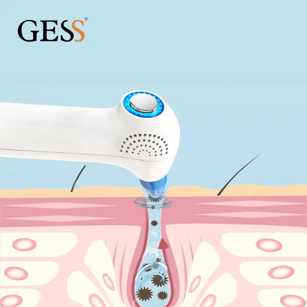 

Hot Sell Frohmen Blackhead Remover With Heat Pad, White