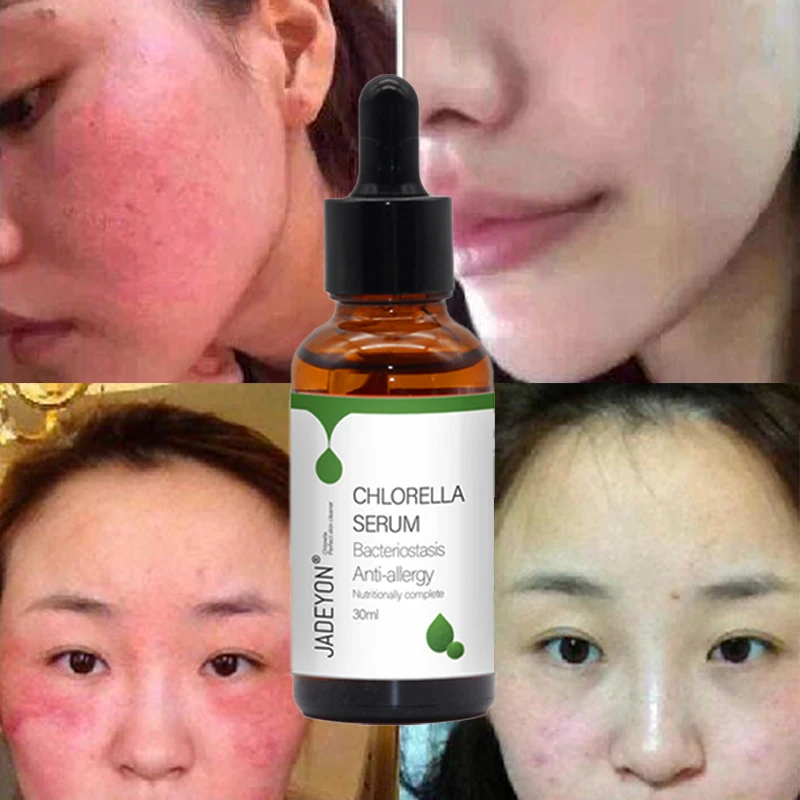 

private label organic vegan whitening repair chlorella microneedling serum hyaluronic acid microneedling serum