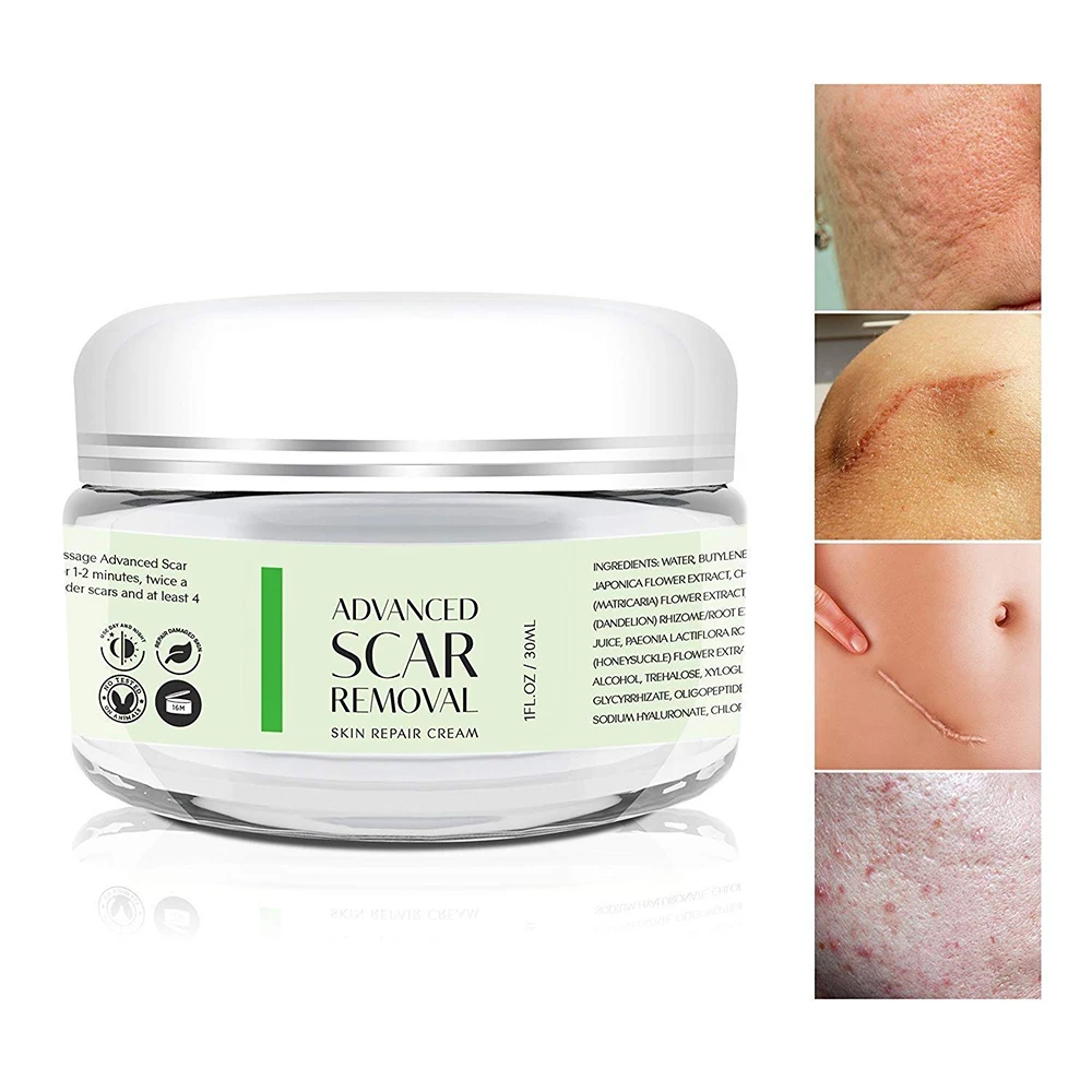 acne scar removal cream for sensitive skin