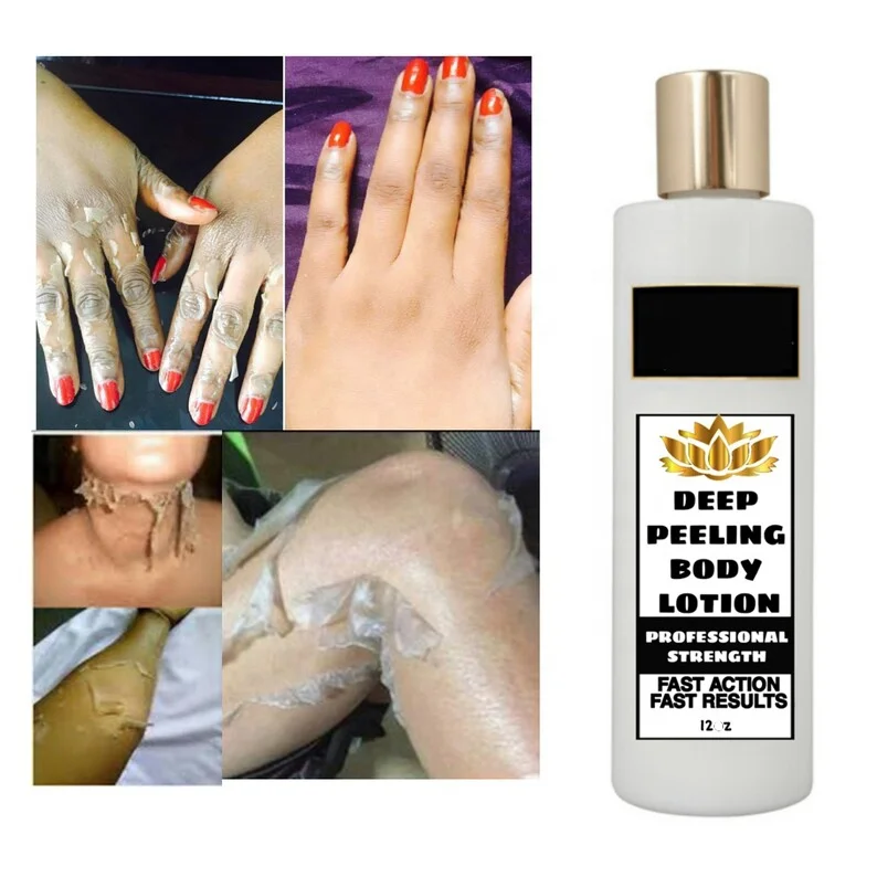 

Extra Strength Fast Deep Peeling Body Lotion Skin Glowing Strong Lightening Whitening Lotion, White color