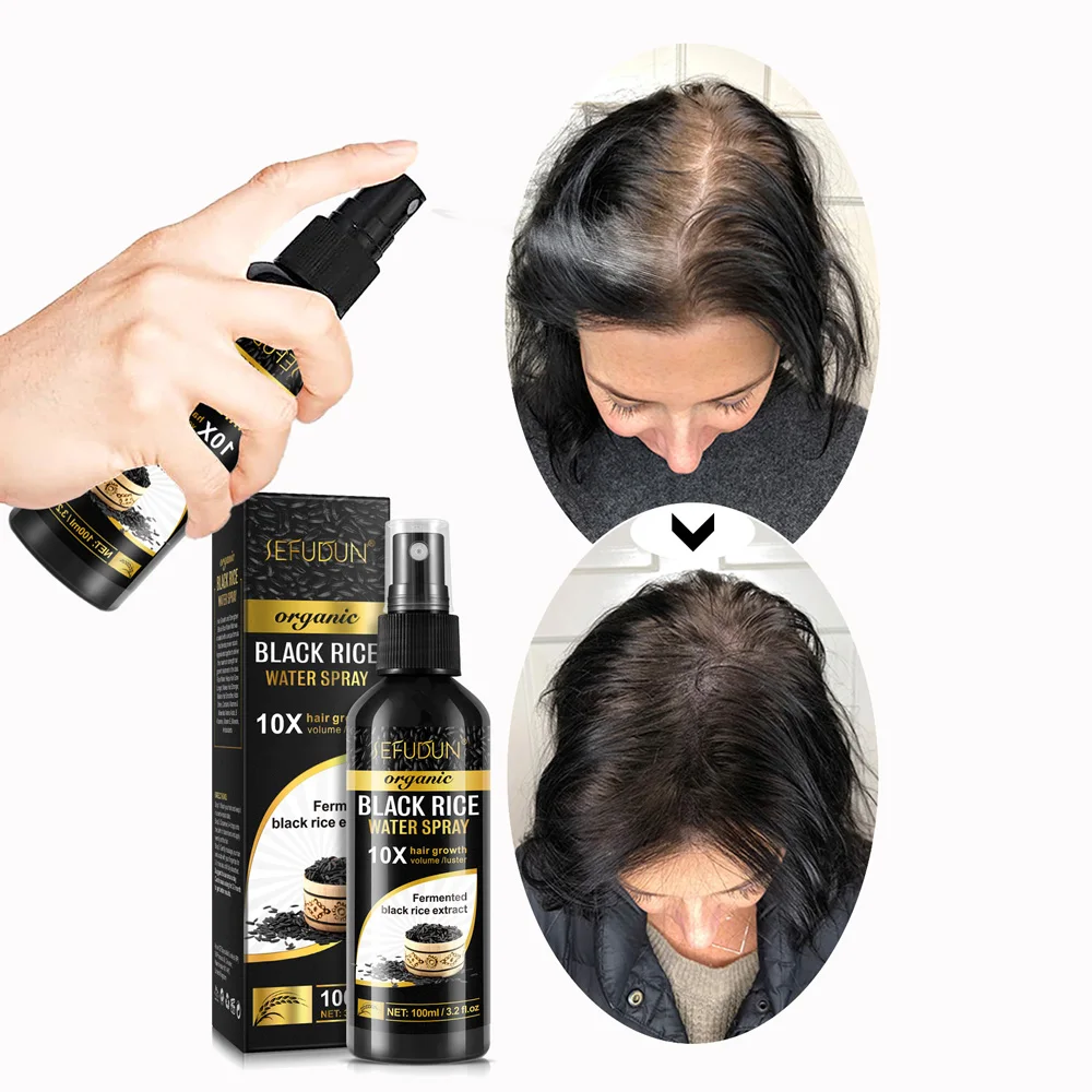 

Fast Grow Hair Treatment Hair Loss Care Spray Biotin Black Rice Water Hair Growth Spray Serum For Men Women 100ml