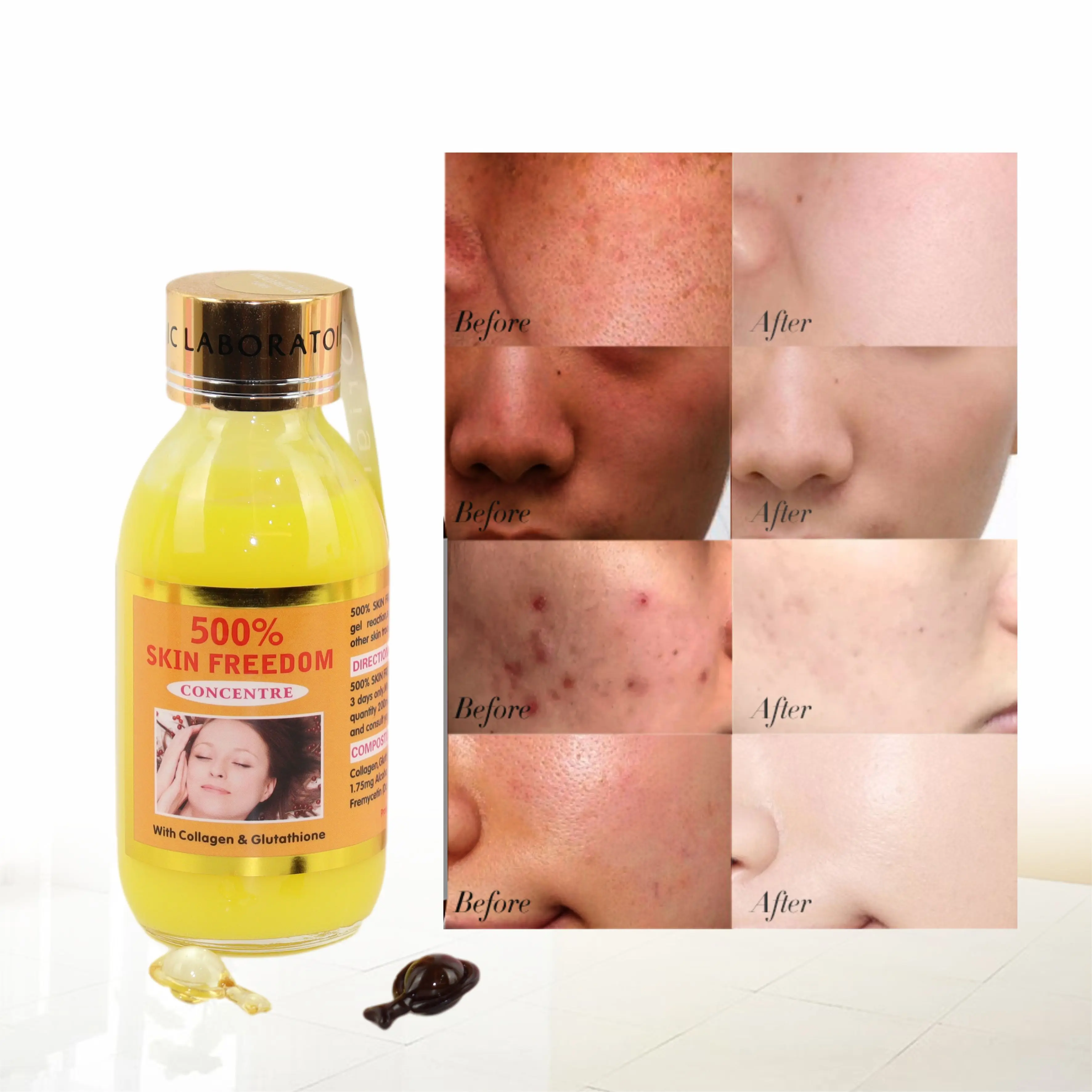 

Private Label Vitamin C Repair Skin Care Dark Spots Removal Beauty Whitening Firming Anti-Aging Microneedling Face Serum
