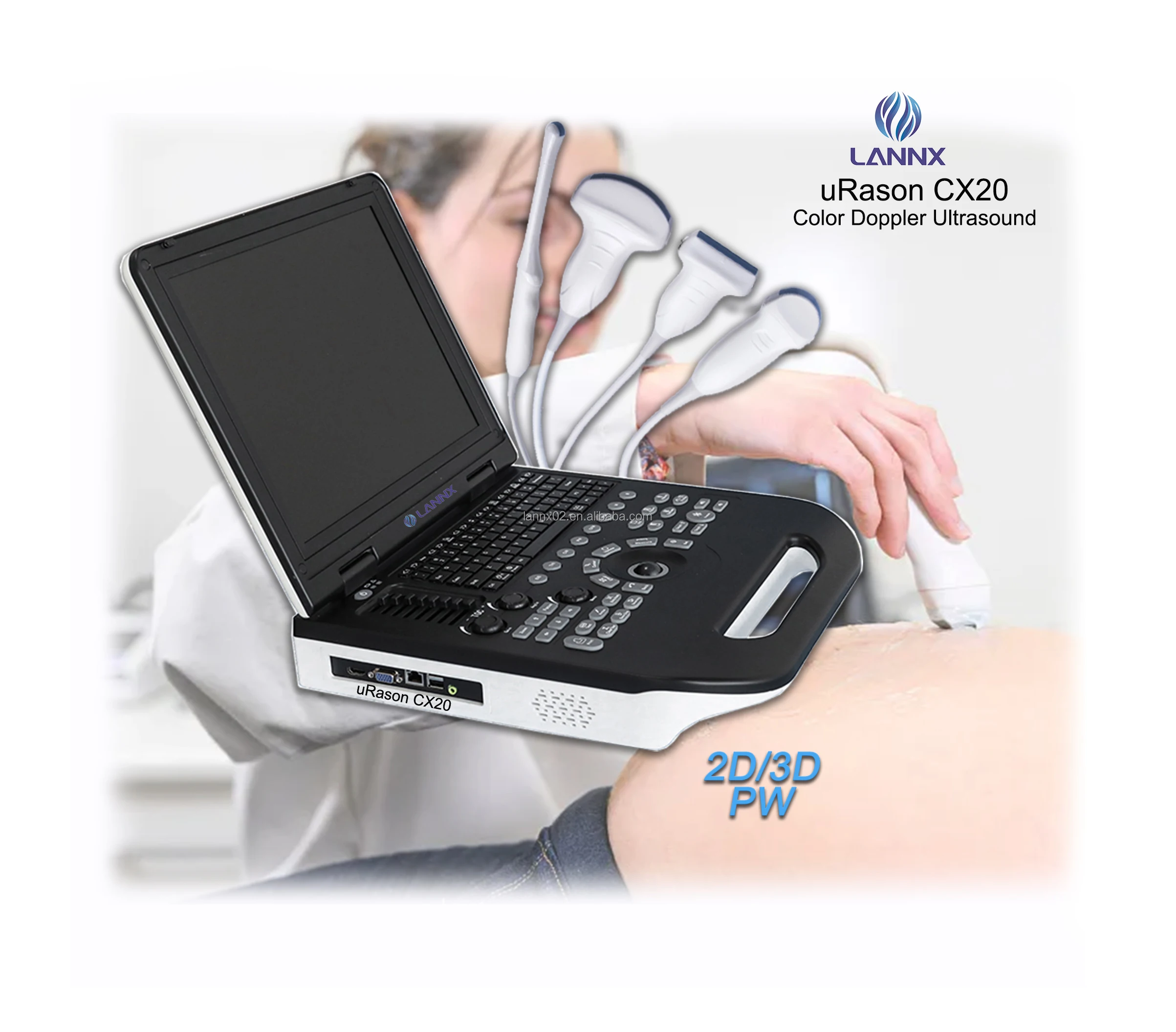 

LANNX uRason CX20 Quick shipping medical Application ultrasonic diagnostic 128 permanents PW color doppler Ultrasound Machine