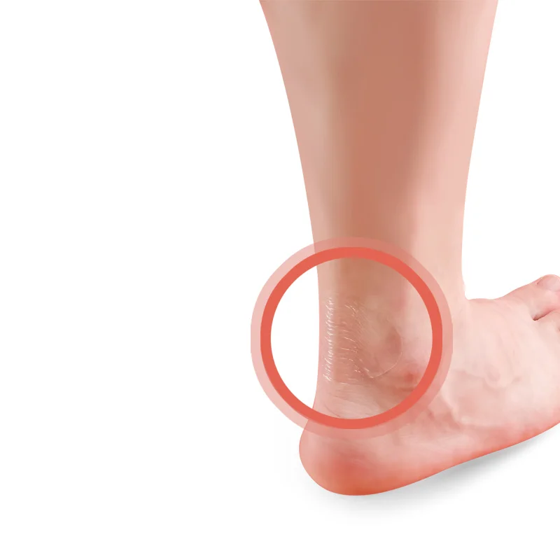 

Heel stickers anti-wear foot stickers invisible multifunctional random stickers high heels anti-wear heel instep anti-wear