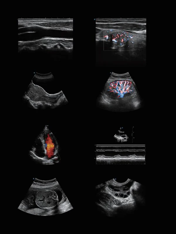 High quality SonoScape P15 colour Doppler ultrasound  machine