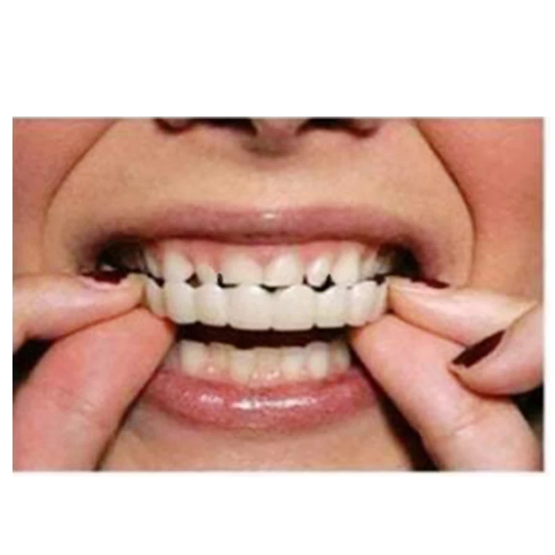 

Truelybeauty Amazon Hot Selling Perfect Smile Snap-on Braces False Teeth Veneers Teeth False Teeth Braces