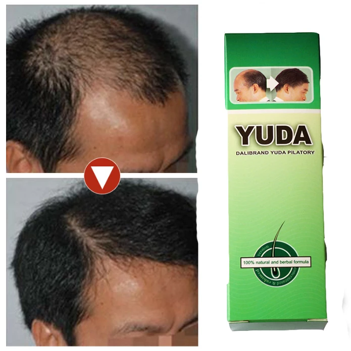 

Hot sale hair beauty care product Yuda hair growth pilatory for men hair extra growth strength
